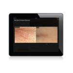 8436.3_ionto-scope_api_100-darstellung1_1