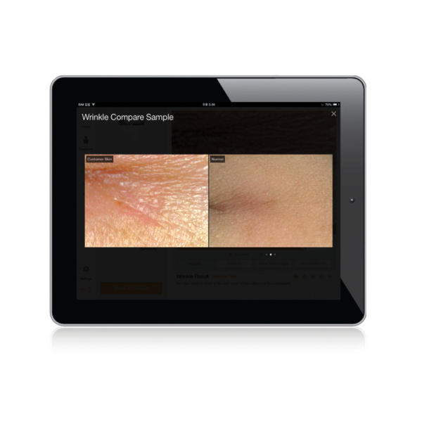 8436.3 ionto scope api 100 darstellung1 1
