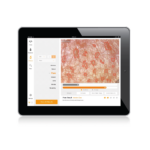 8436.3_ionto-scope_api_100-darstellung2_1