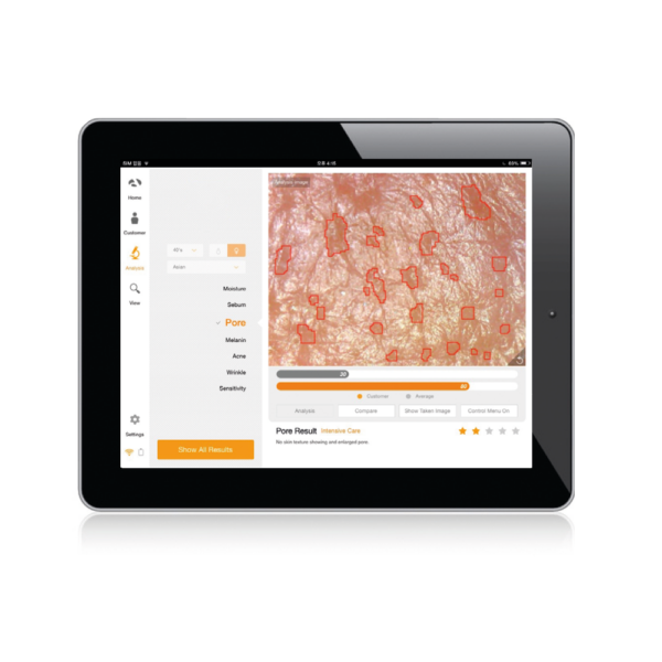 8436.3 ionto scope api 100 darstellung2 1